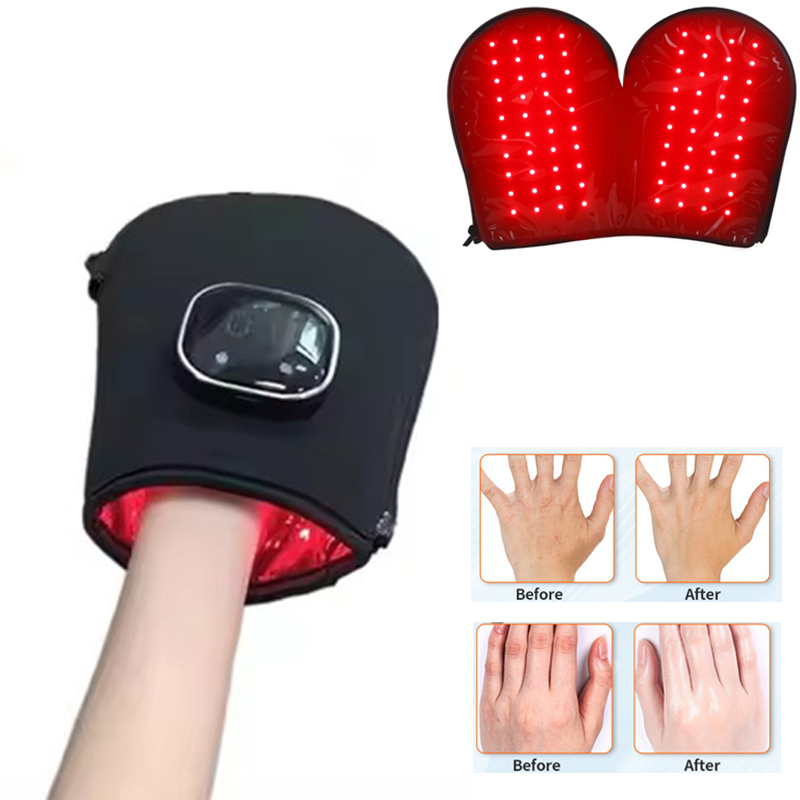 อุปกรณ์บำบัดด้วยแสงสีแดงรุ่นให - Red Light Therapy Device บทวิจารณ์และราคา